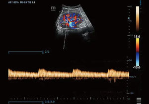 
                  
                    KZ60 Affordable Color Doppler Ultrasound | KeeboMed
                  
                