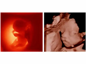 
                  
                    KZ60 Affordable Color Doppler Ultrasound | KeeboMed
                  
                