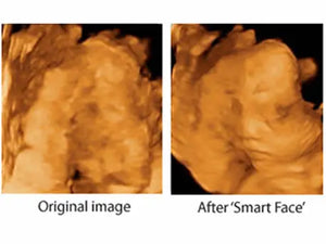 
                  
                    KZ60 Affordable Color Doppler Ultrasound | KeeboMed
                  
                