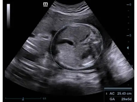 
                  
                    KZ60 Affordable Color Doppler Ultrasound | KeeboMed
                  
                