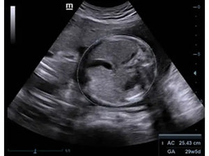 
                  
                    KZ60 Affordable Color Doppler Ultrasound | KeeboMed
                  
                