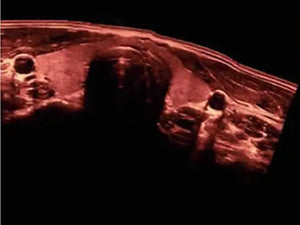 
                  
                    KZ60 Affordable Color Doppler Ultrasound | KeeboMed
                  
                