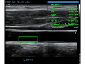 
                  
                    KZ60 Affordable Color Doppler Ultrasound | KeeboMed
                  
                