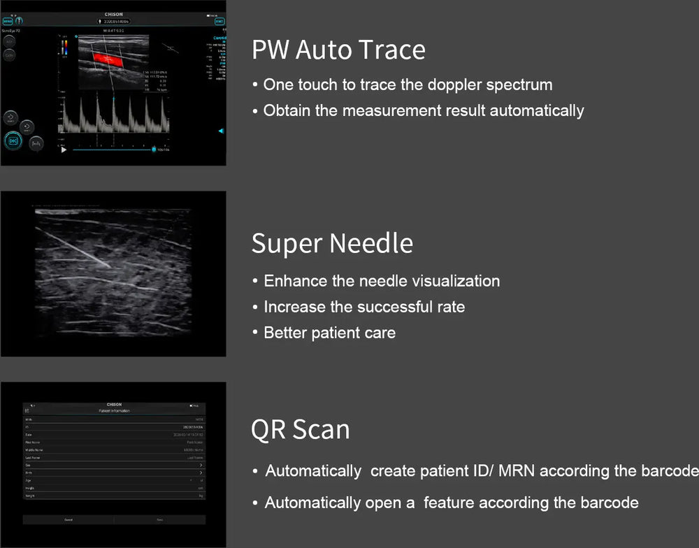 
                  
                    Chison SonoEye P1 Linear Array Mobile Smartphone Handheld Ultrasound | KeeboMed
                  
                