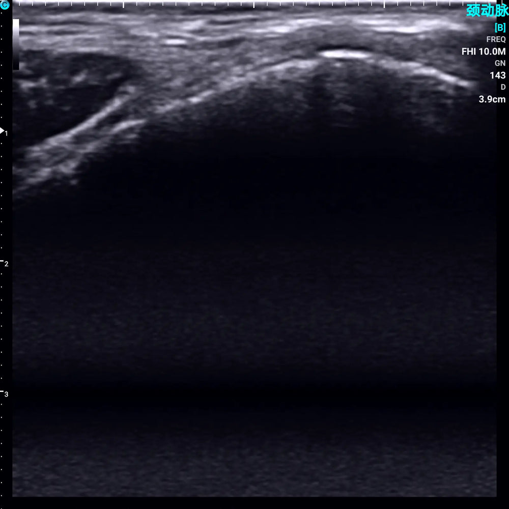 
                  
                    Chison SonoEye P1 Linear Array Mobile Smartphone Handheld Ultrasound Knee | KeeboMed
                  
                