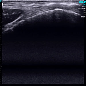 
                  
                    Chison SonoEye P1 Linear Array Mobile Smartphone Handheld Ultrasound Knee | KeeboMed
                  
                