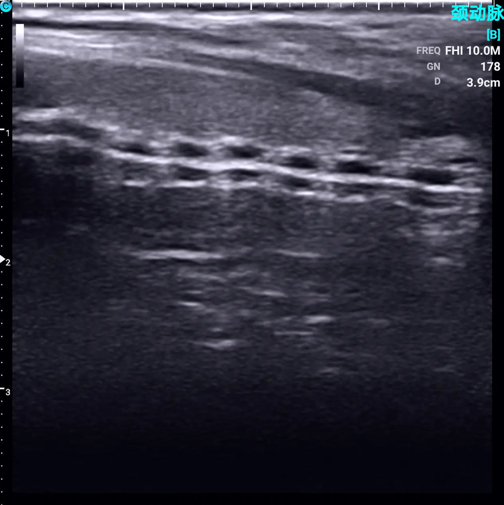 
                  
                    Chison SonoEye P1 Linear Array Mobile Smartphone Handheld Ultrasound Trachea | KeeboMed
                  
                