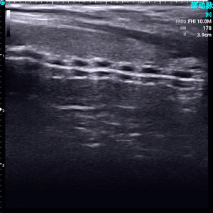 
                  
                    Chison SonoEye P1 Linear Array Mobile Smartphone Handheld Ultrasound Trachea | KeeboMed
                  
                