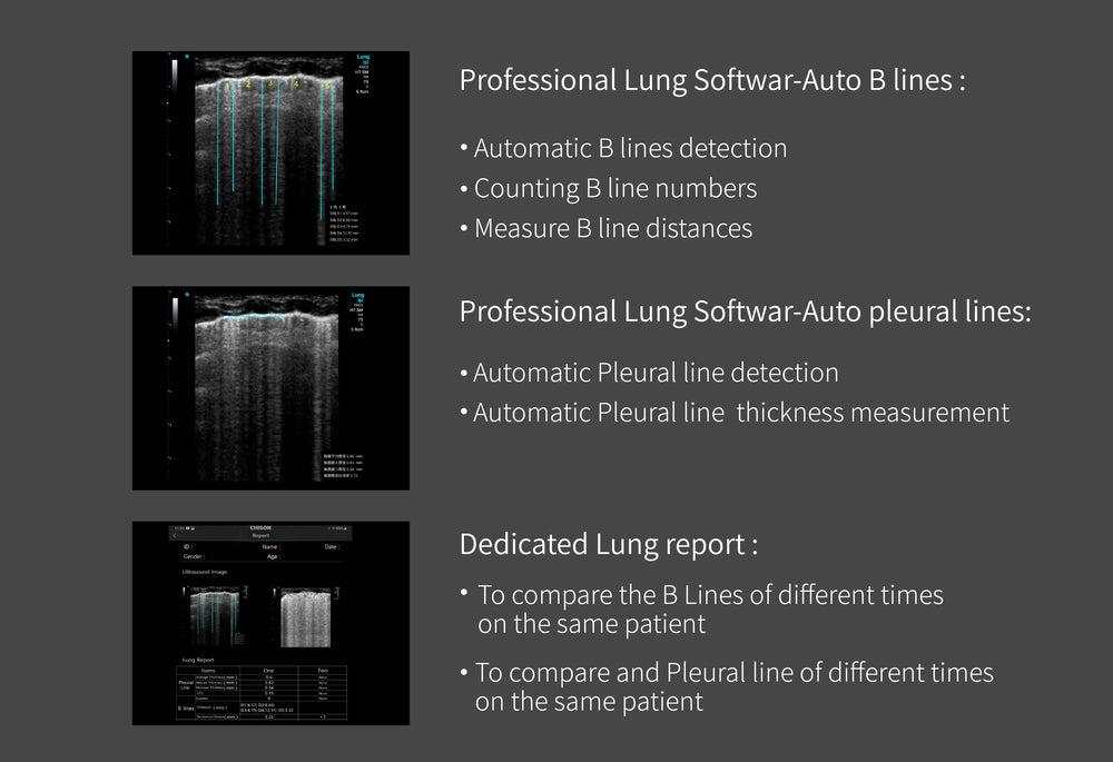 
                  
                    Chison SonoEye P2 Linear Array Smartphone Mobile Ultrasound | KeeboMed
                  
                