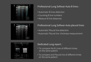 
                  
                    Chison SonoEye P2 Linear Array Smartphone Mobile Ultrasound | KeeboMed
                  
                