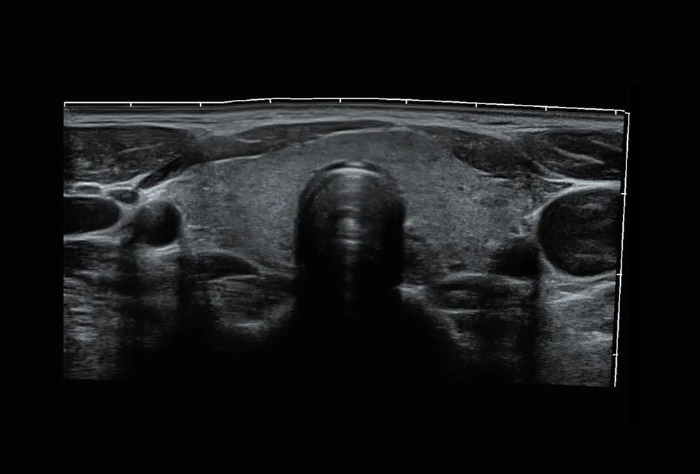 
                  
                    SonoScape P10 Trolley Color Doppler Ultrasound
                  
                