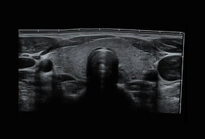 
                  
                    SonoScape P10 Trolley Color Doppler Ultrasound
                  
                