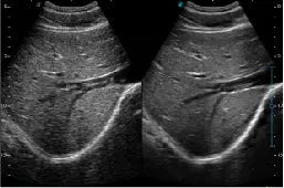 
                  
                    SonoScape P10 Trolley Color Doppler Ultrasound
                  
                