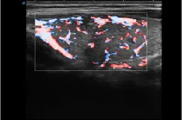 
                  
                    SonoScape P10 Trolley Color Doppler Ultrasound
                  
                