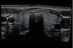 
                  
                    SonoScape P10 Trolley Color Doppler Ultrasound
                  
                
