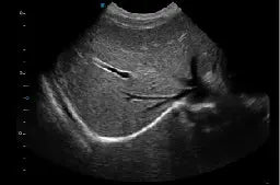 
                  
                    SonoScape P10 Trolley Color Doppler Ultrasound
                  
                