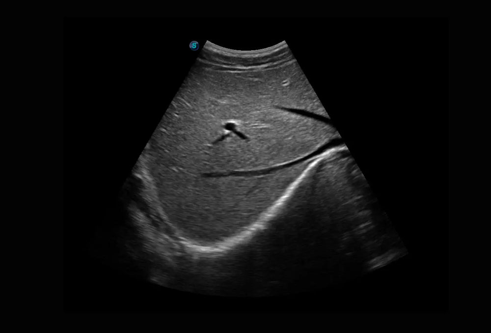 
                  
                    SonoScape P10 Trolley Color Doppler Ultrasound
                  
                