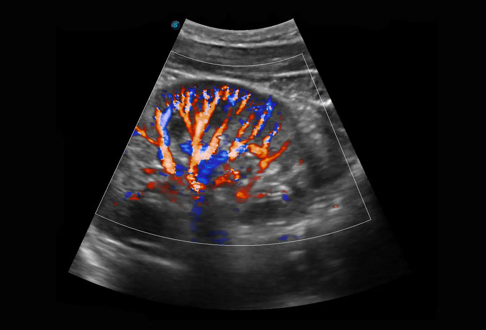 
                  
                    SonoScape P10 Trolley Color Doppler Ultrasound
                  
                