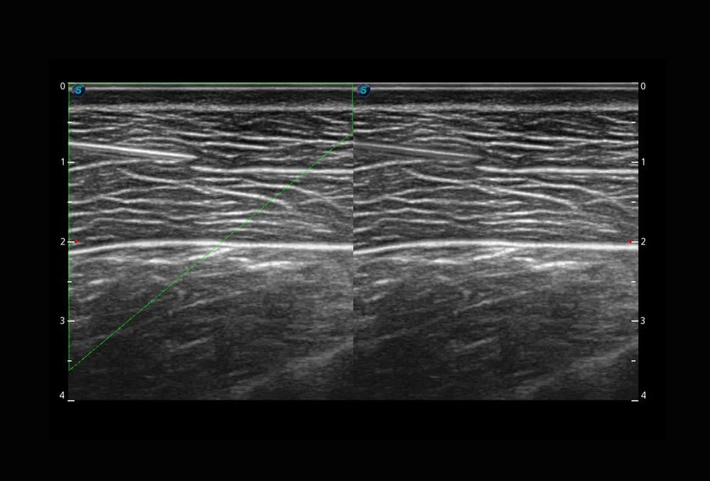 
                  
                    SonoScape P10 Trolley Color Doppler Ultrasound
                  
                