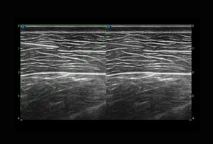 
                  
                    SonoScape P10 Trolley Color Doppler Ultrasound
                  
                