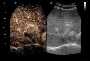 
                  
                    SonoScape P20 Trolley Color Doppler Ultrasound
                  
                