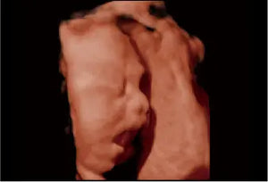 
                  
                    SonoScape P20 Trolley Color Doppler Ultrasound
                  
                