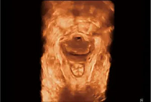 
                  
                    SonoScape P20 Trolley Color Doppler Ultrasound
                  
                