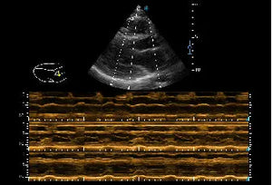 
                  
                    SonoScape P20 Trolley Color Doppler Ultrasound
                  
                