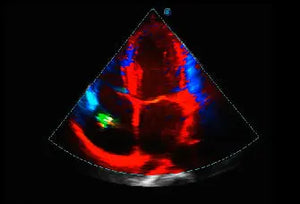 
                  
                    SonoScape P20 Trolley Color Doppler Ultrasound
                  
                