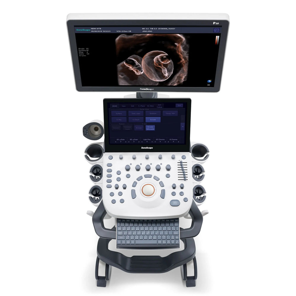
                  
                    SonoScape P20 Trolley Color Doppler Ultrasound
                  
                