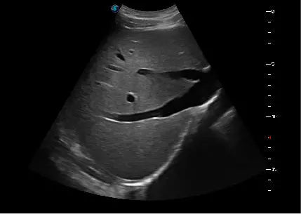 
                  
                    SonoScape P20 Trolley Color Doppler Ultrasound
                  
                