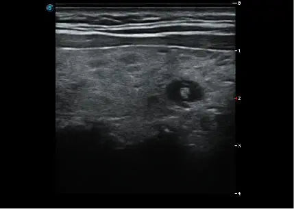
                  
                    SonoScape P20 Trolley Color Doppler Ultrasound
                  
                