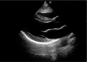 
                  
                    SonoScape P20 Trolley Color Doppler Ultrasound
                  
                