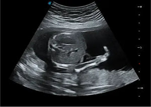 
                  
                    SonoScape P20 Trolley Color Doppler Ultrasound
                  
                