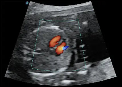 
                  
                    SonoScape P20 Trolley Color Doppler Ultrasound
                  
                