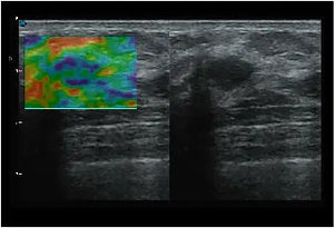 
                  
                    SonoScape P20 Trolley Color Doppler Ultrasound
                  
                