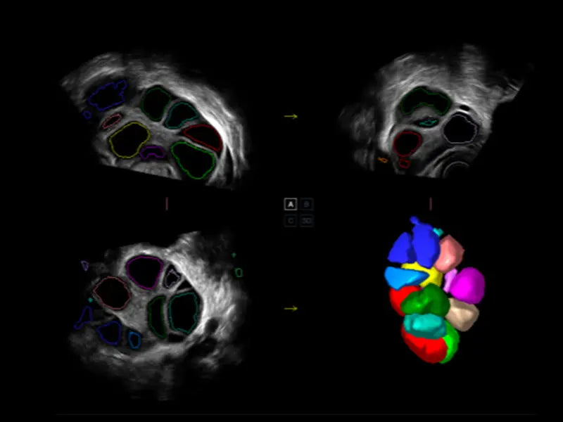 
                  
                    SonoScape P50 Trolley Color Doppler
                  
                