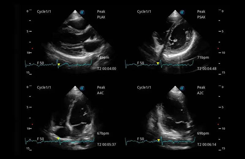 
                  
                    SonoScape P50 Trolley Color Doppler
                  
                