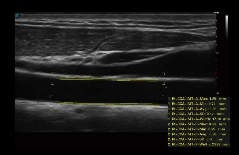 
                  
                    SonoScape P50 Trolley Color Doppler
                  
                