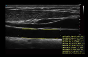 
                  
                    SonoScape P50 Trolley Color Doppler
                  
                