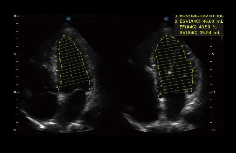 
                  
                    SonoScape P50 Trolley Color Doppler
                  
                