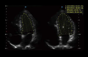 
                  
                    SonoScape P50 Trolley Color Doppler
                  
                