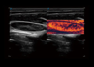 
                  
                    SonoScape P60 Trolley Color Doppler
                  
                