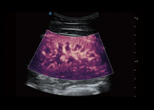
                  
                    SonoScape P60 Trolley Color Doppler
                  
                