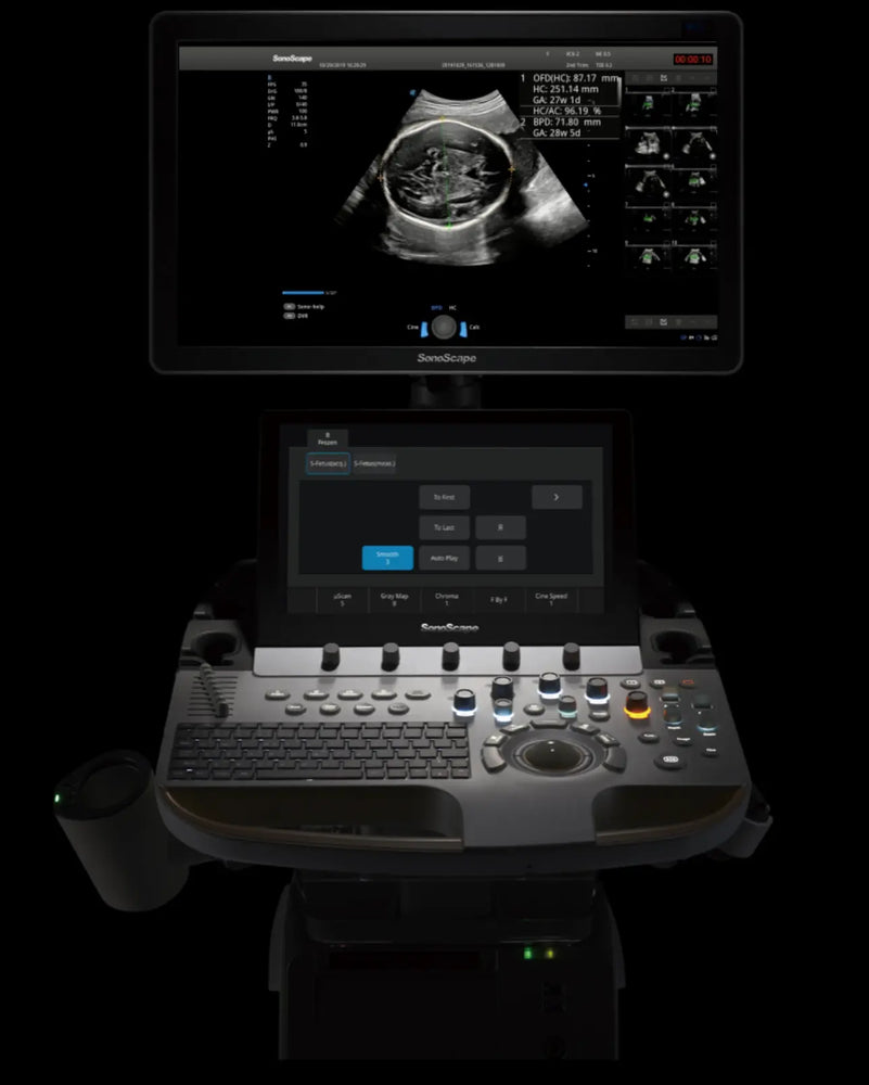 
                  
                    SonoScape P60 Trolley Color Doppler
                  
                