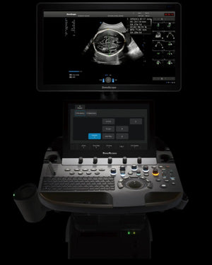 
                  
                    SonoScape P60 Trolley Color Doppler
                  
                