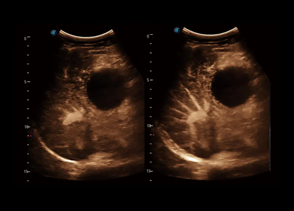 
                  
                    SonoScape P60 Trolley Color Doppler
                  
                