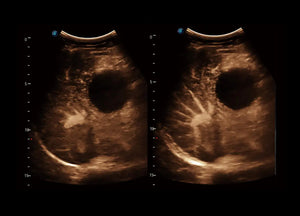 
                  
                    SonoScape P60 Trolley Color Doppler
                  
                