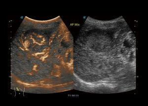 
                  
                    SonoScape P60 Trolley Color Doppler
                  
                