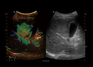
                  
                    SonoScape P60 Trolley Color Doppler
                  
                